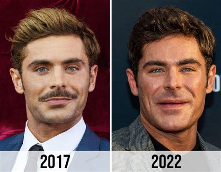 Unmasking The Truth Behind George Lopez's Facial Transformation